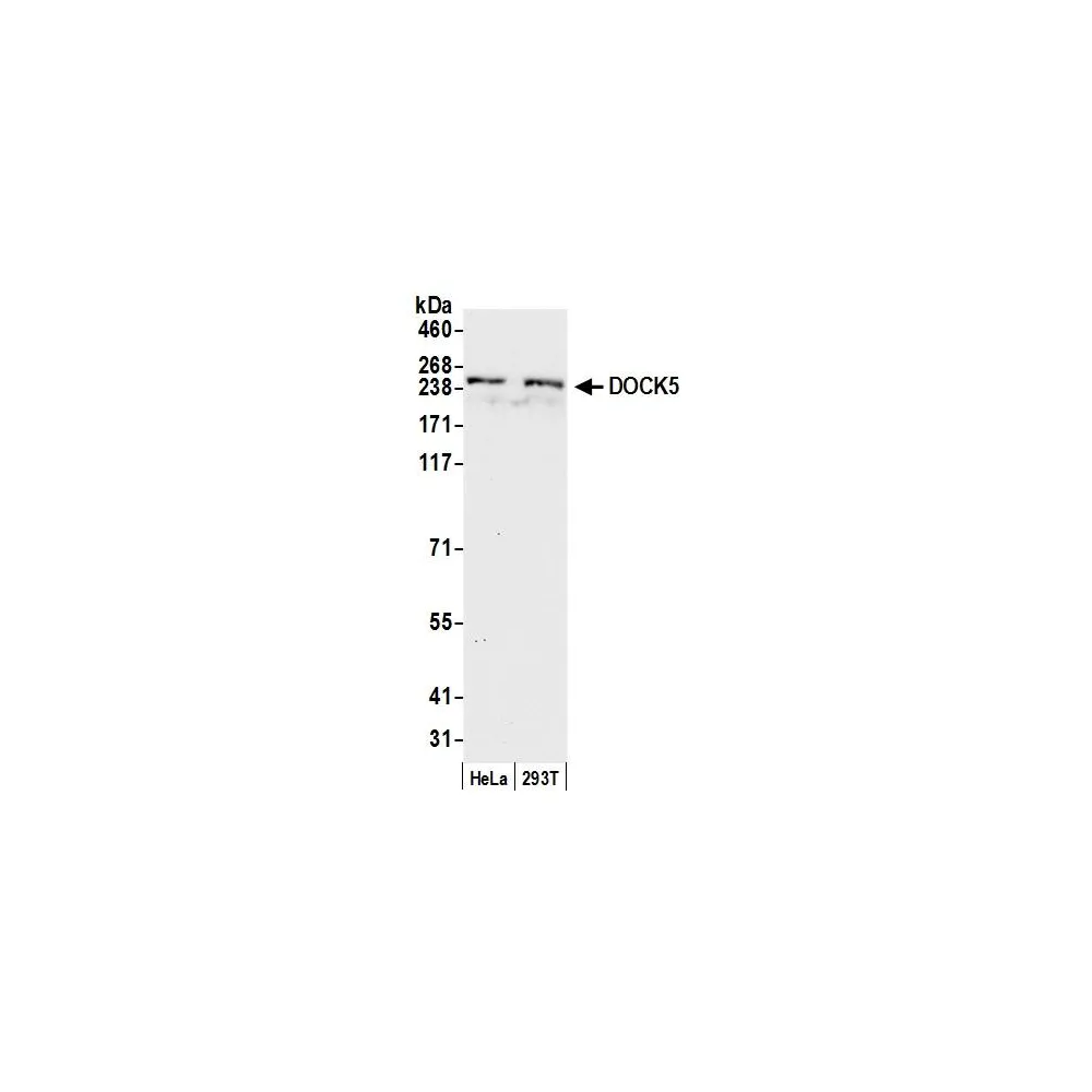 Rabbit anti-DOCK5 Antibody, Affinity Purified