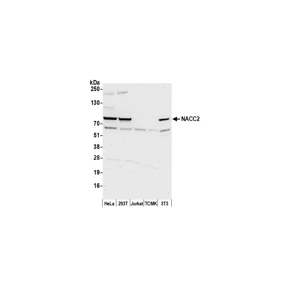 Rabbit anti-NACC2/BTBD14A Antibody, Affinity Purified