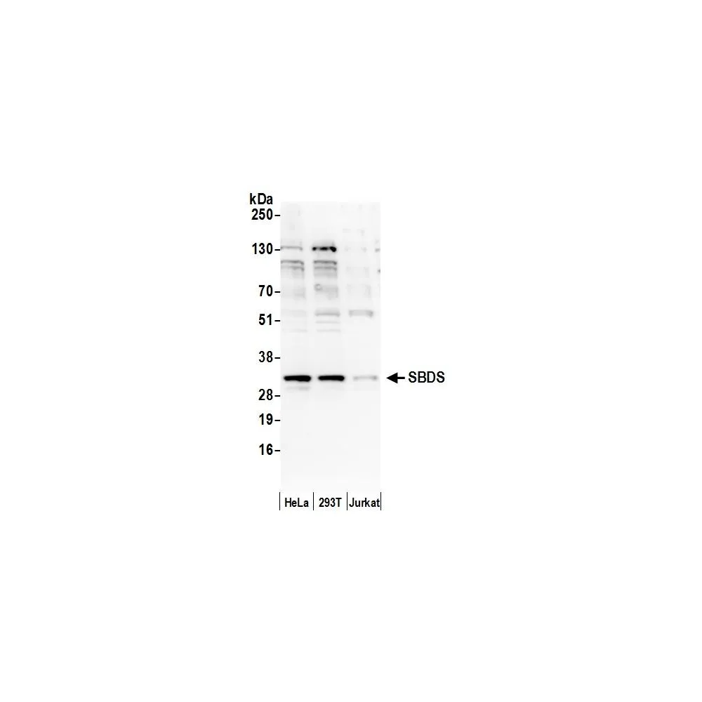 Rabbit anti-Shwachman-Bodian-Diamond Syndrome/SBDS Antibody, Affinity Purified