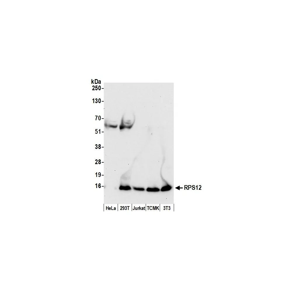 Rabbit anti-RPS12/Ribosomal Protein S12 Antibody, Affinity Purified
