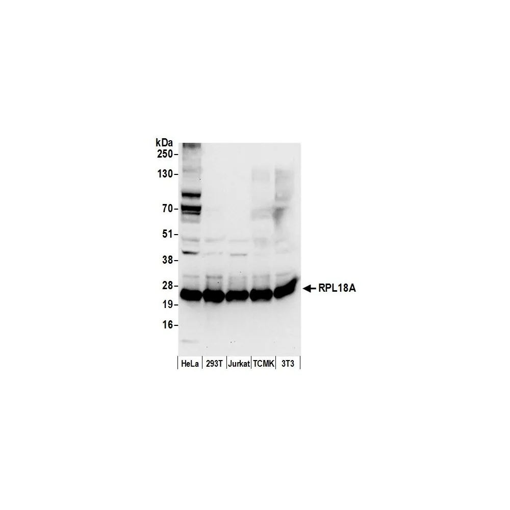 Rabbit anti-RPL18A/Ribosomal Protein L18a Antibody, Affinity Purified