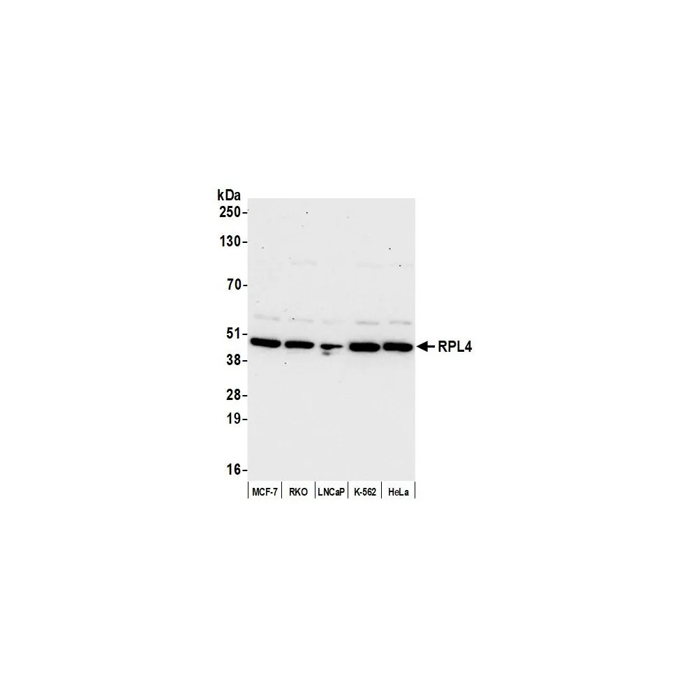 Rabbit anti-RPL4/Ribosomal Protein L4 Antibody, Affinity Purified