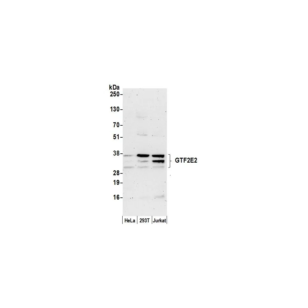 Rabbit anti-GTF2E2/TF2E2/TFIIE-beta Antibody, Affinity Purified
