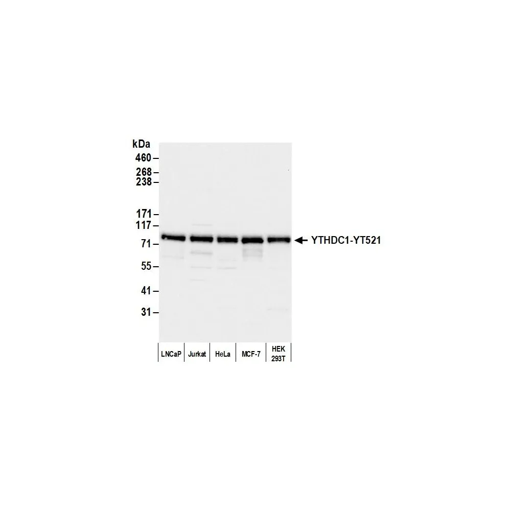 Rabbit anti-YTHDC1/YT521 Antibody, Affinity Purified