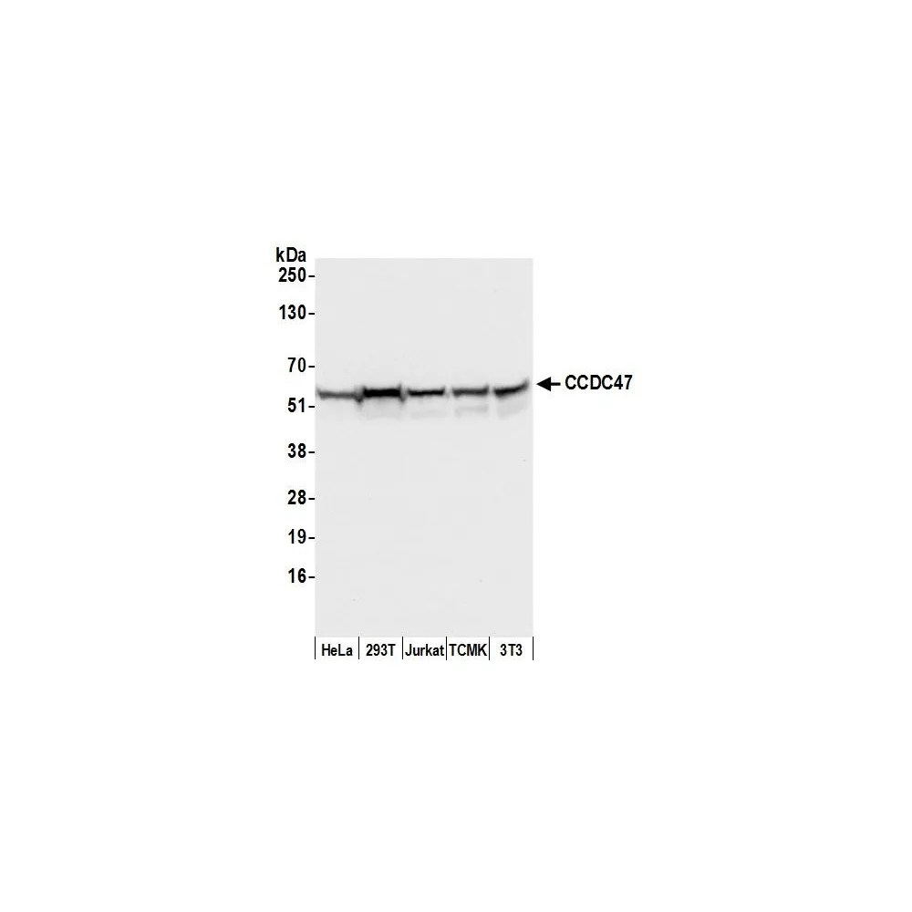 Rabbit anti-CCDC47 Antibody, Affinity Purified