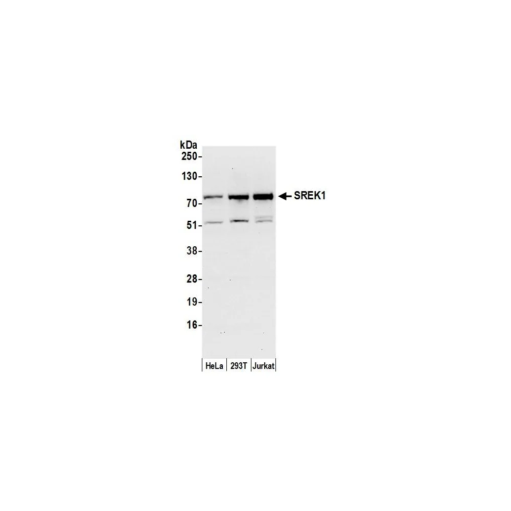 Rabbit anti-SREK1/SFRS12 Antibody, Affinity Purified