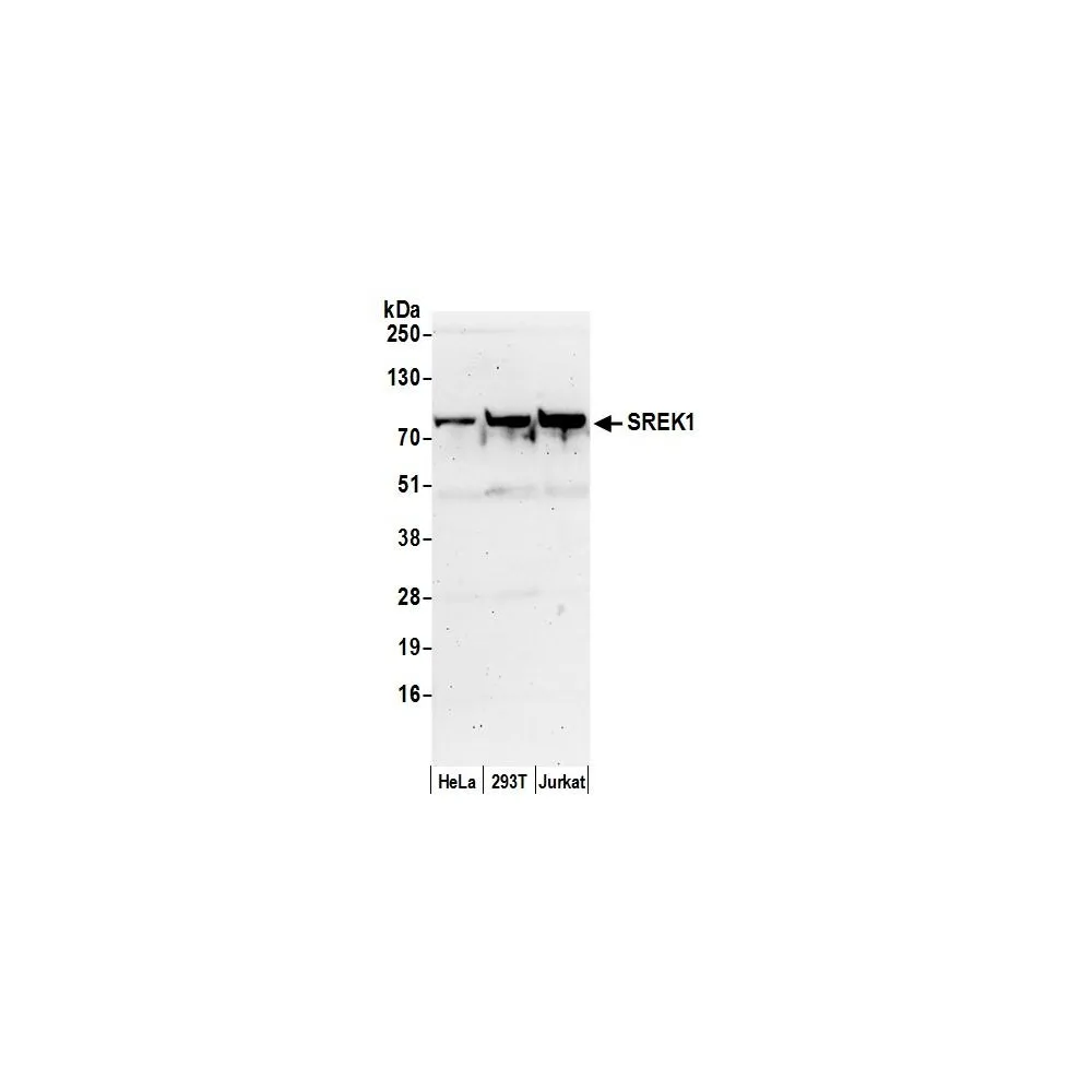 Rabbit anti-SREK1/SFRS12 Antibody, Affinity Purified