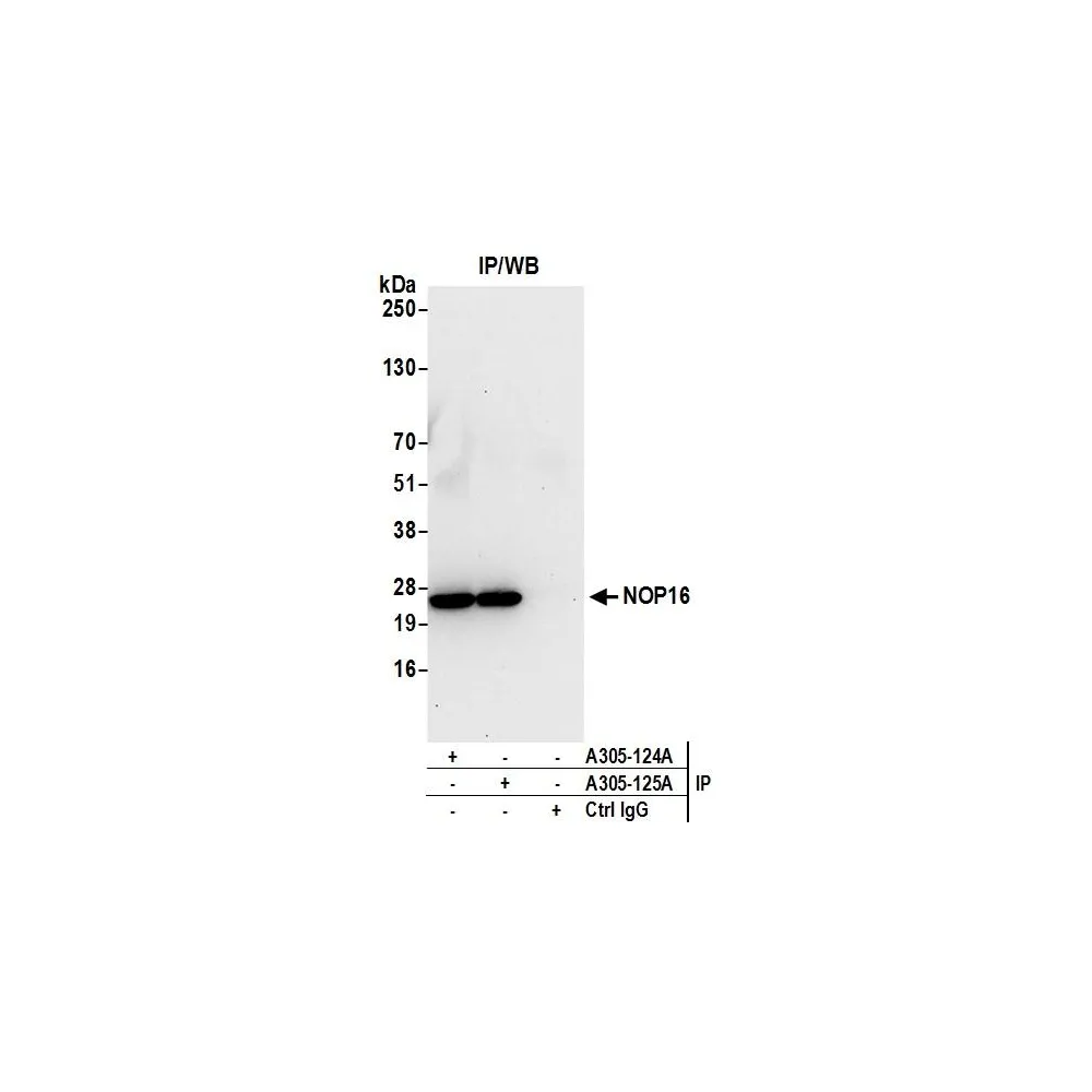 Rabbit anti-NOP16/HSPC111 Antibody, Affinity Purified