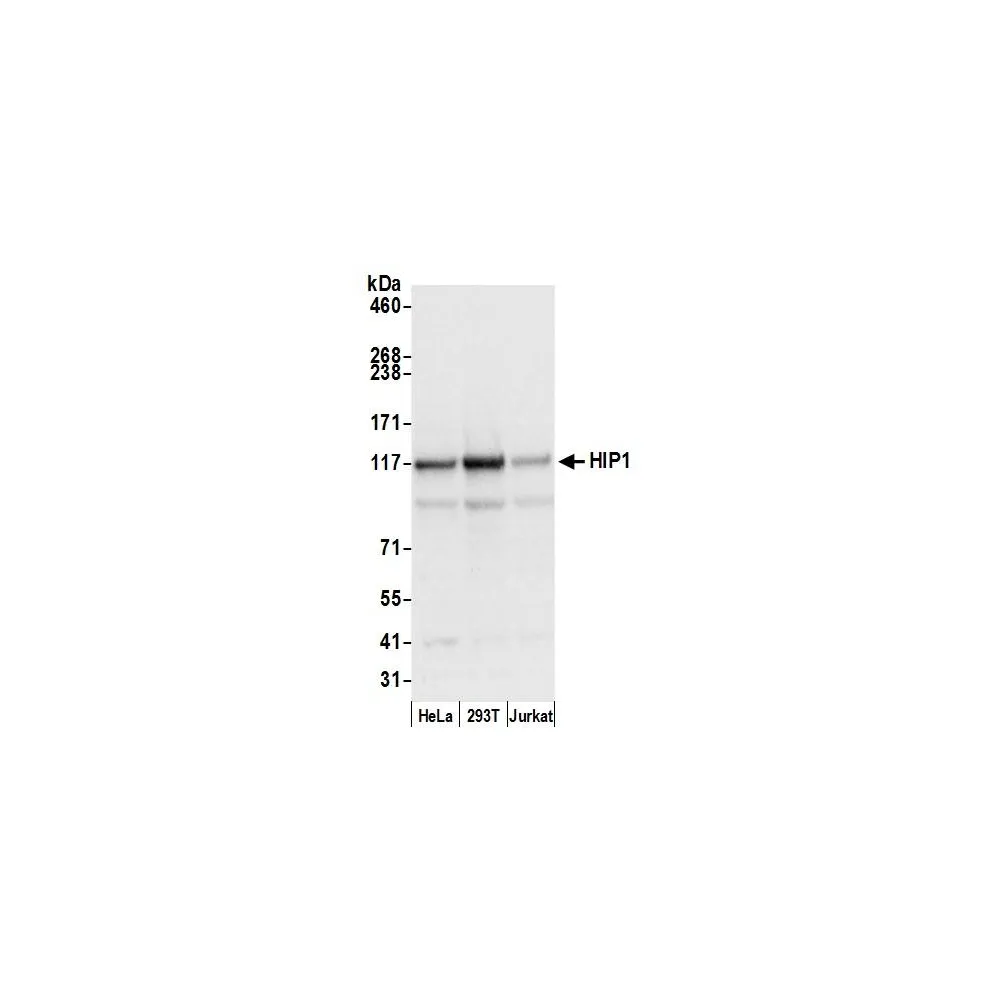 Rabbit anti-HIP1/Huntingtin-interacting Protein 1 Antibody, Affinity Purified