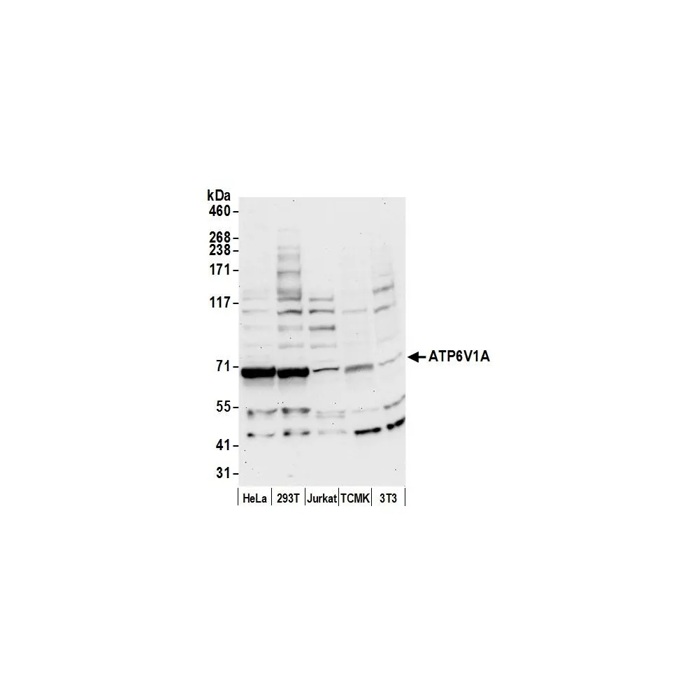 Rabbit anti-ATP6V1A Antibody, Affinity Purified