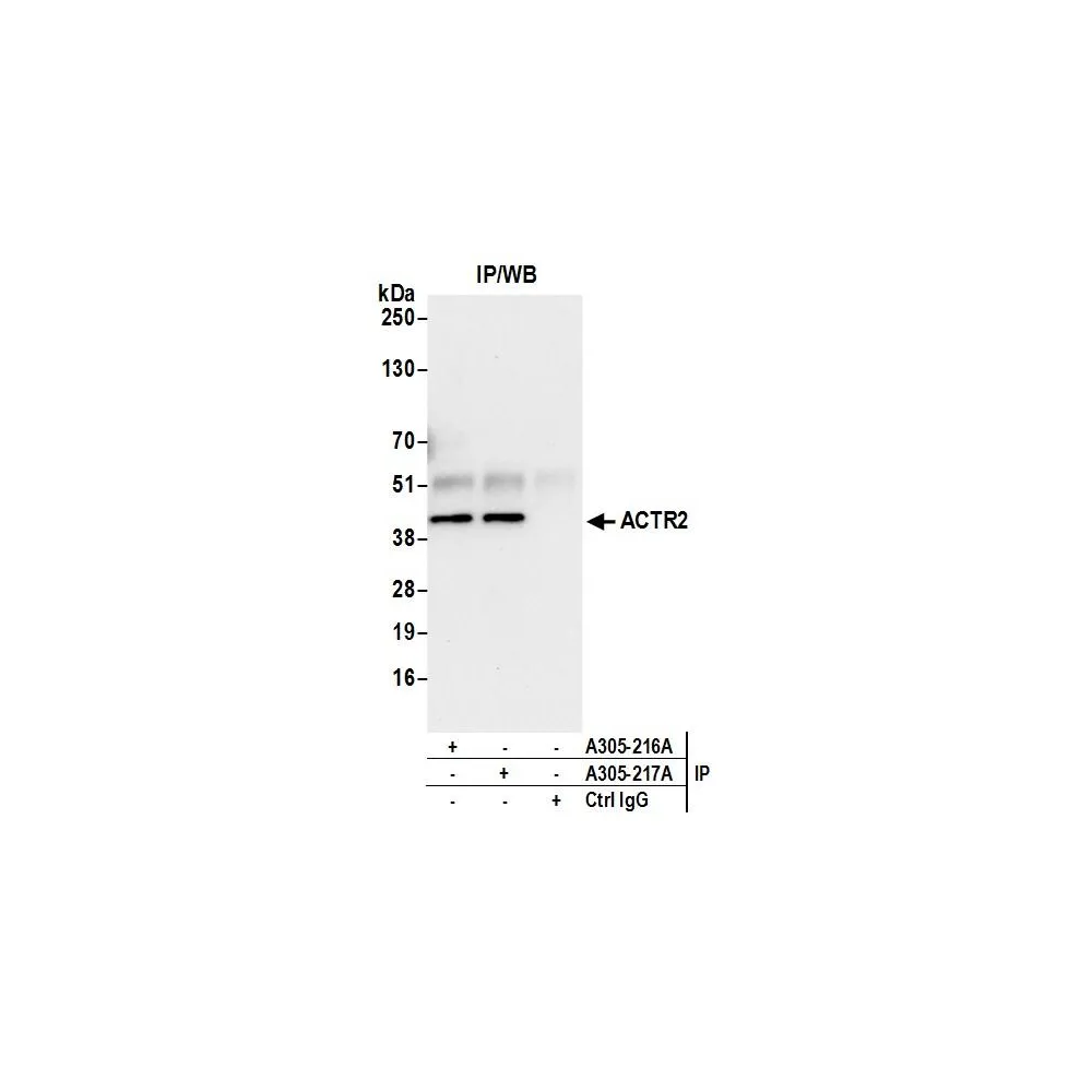 Rabbit anti-ACTR2/ARP2 Antibody, Affinity Purified