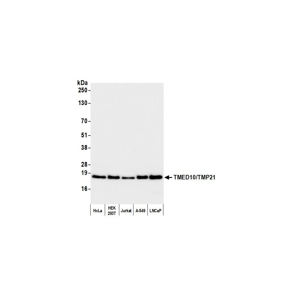 Rabbit anti-TMED10/TMP21 Antibody, Affinity Purified