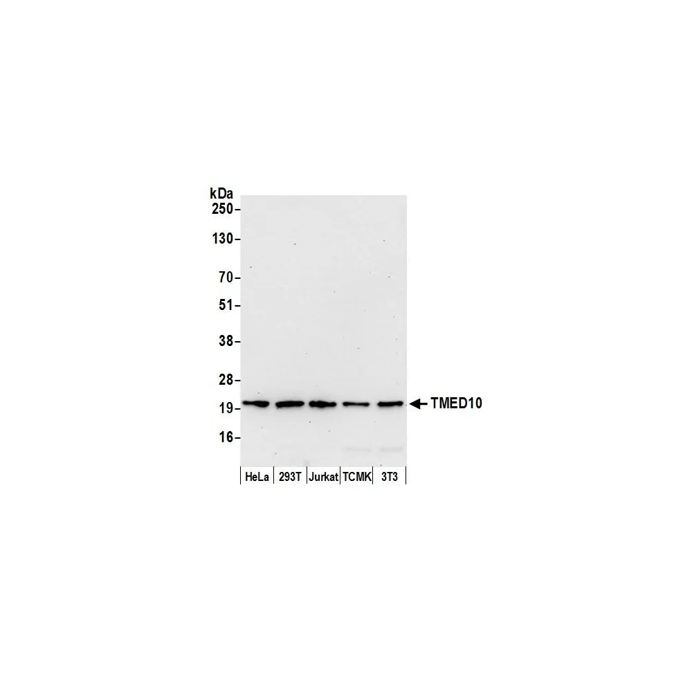 Rabbit anti-TMED10/TMP21 Antibody, Affinity Purified