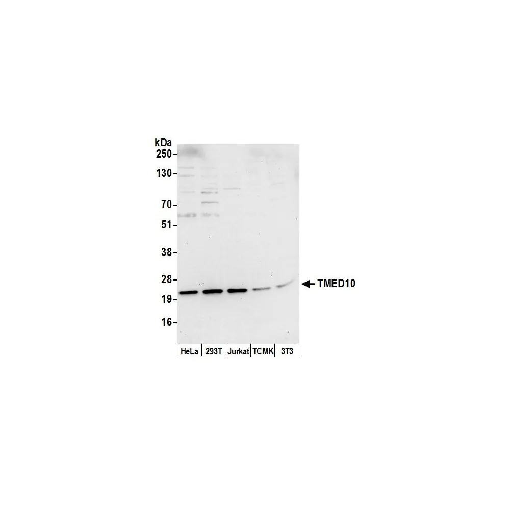 Rabbit anti-TMED10/TMP21 Antibody, Affinity Purified