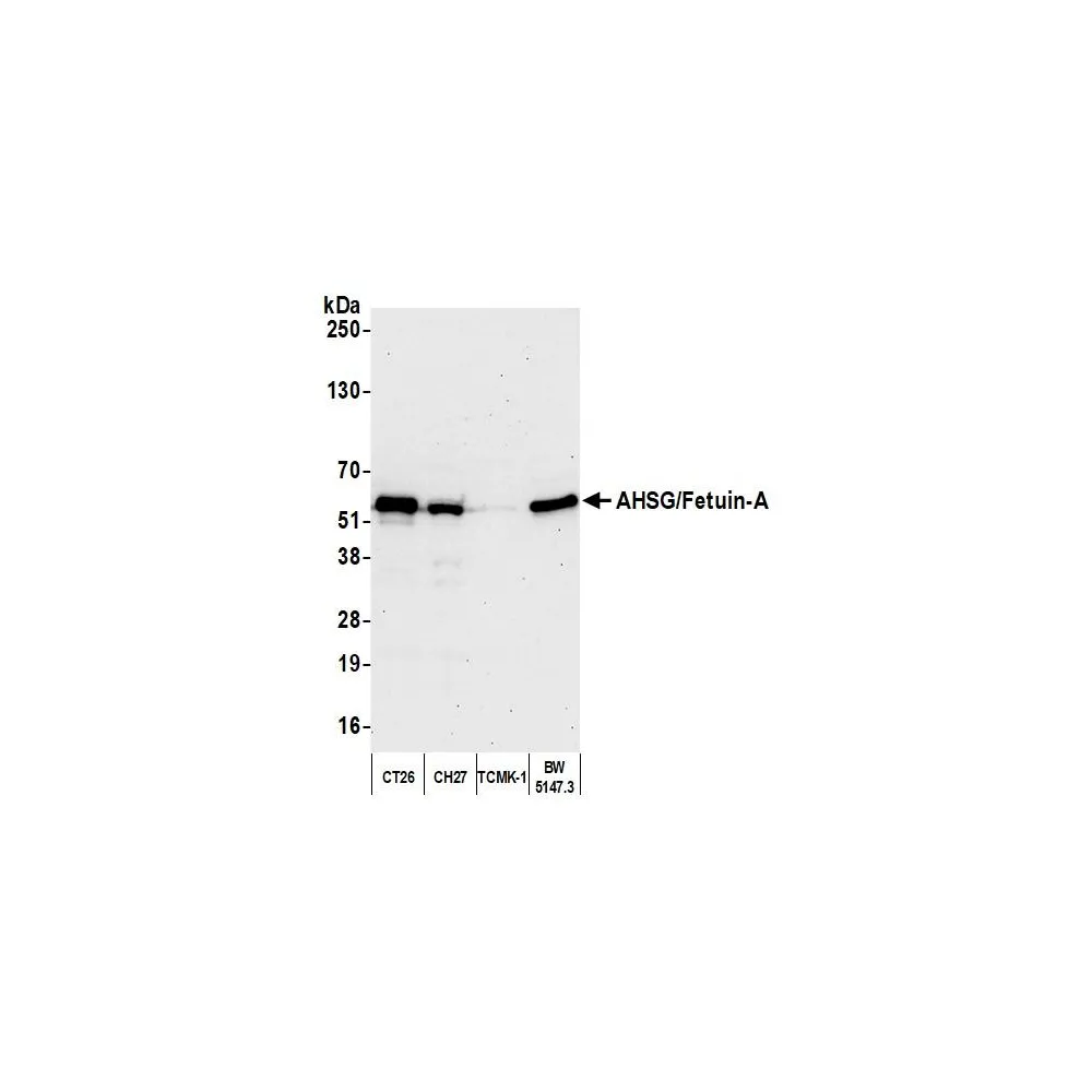 Rabbit anti-AHSG/Fetuin-A Antibody, Affinity Purified