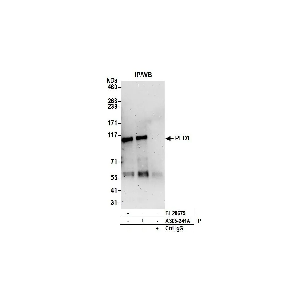Rabbit anti-PLD1/Phospholipase D1 Antibody, Affinity Purified
