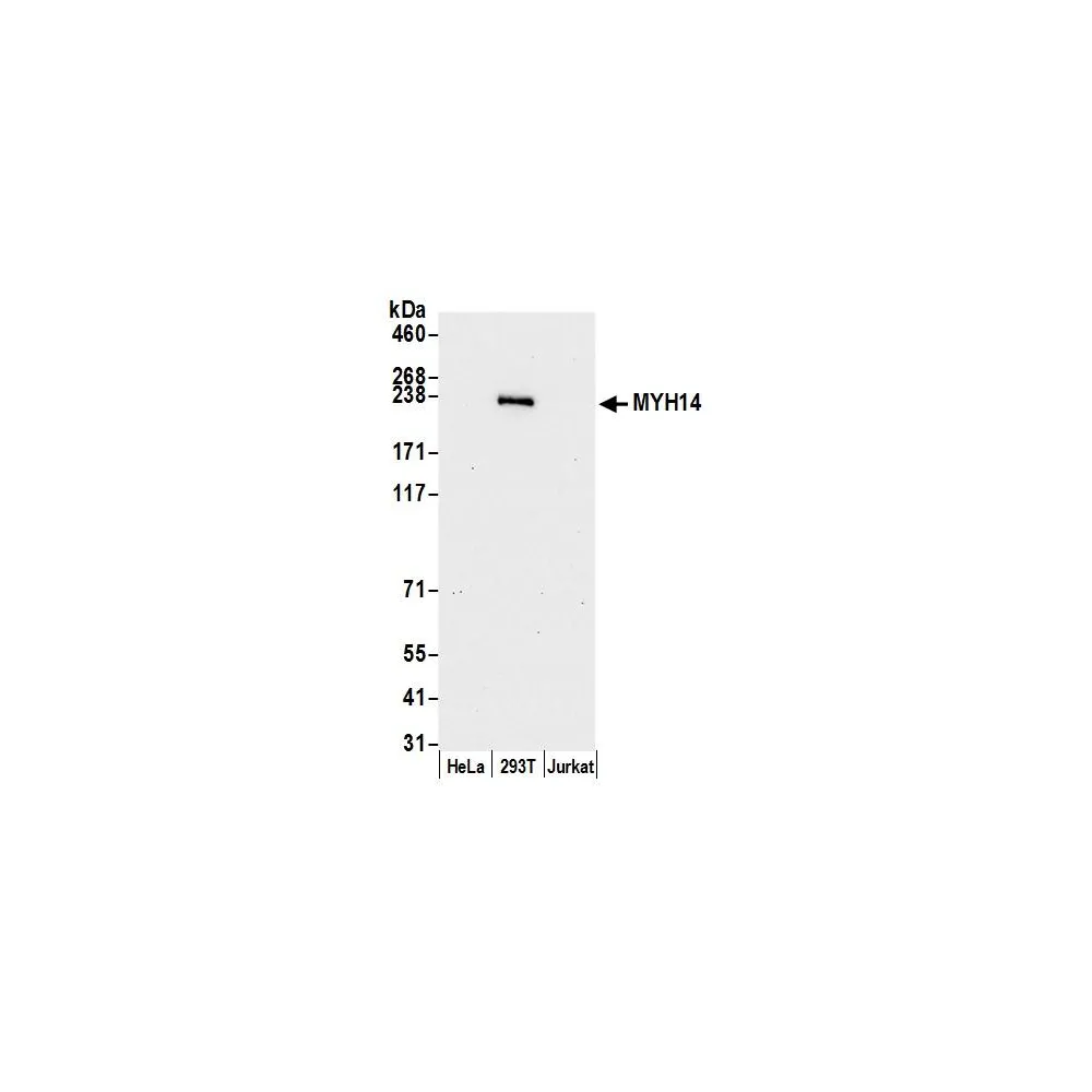 Rabbit anti-MYH14/Myosin-14 Antibody, Affinity Purified