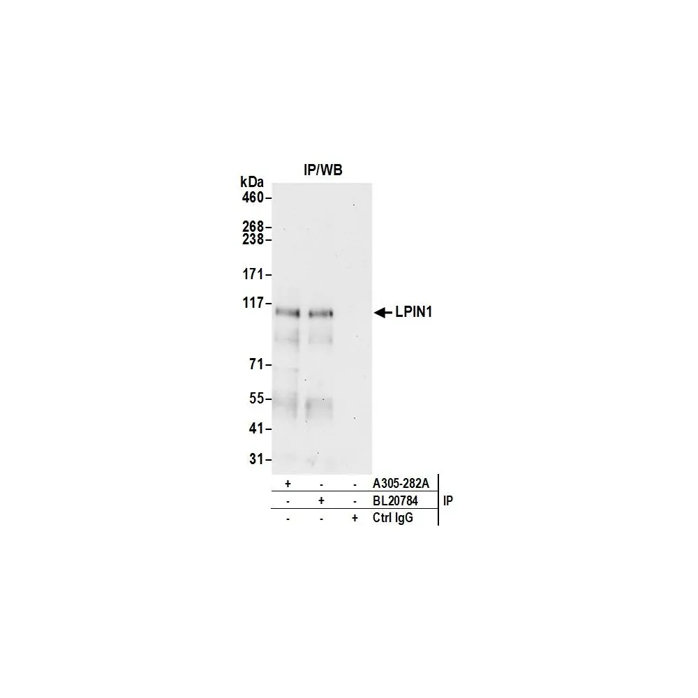 Rabbit anti-LPIN1 Antibody, Affinity Purified