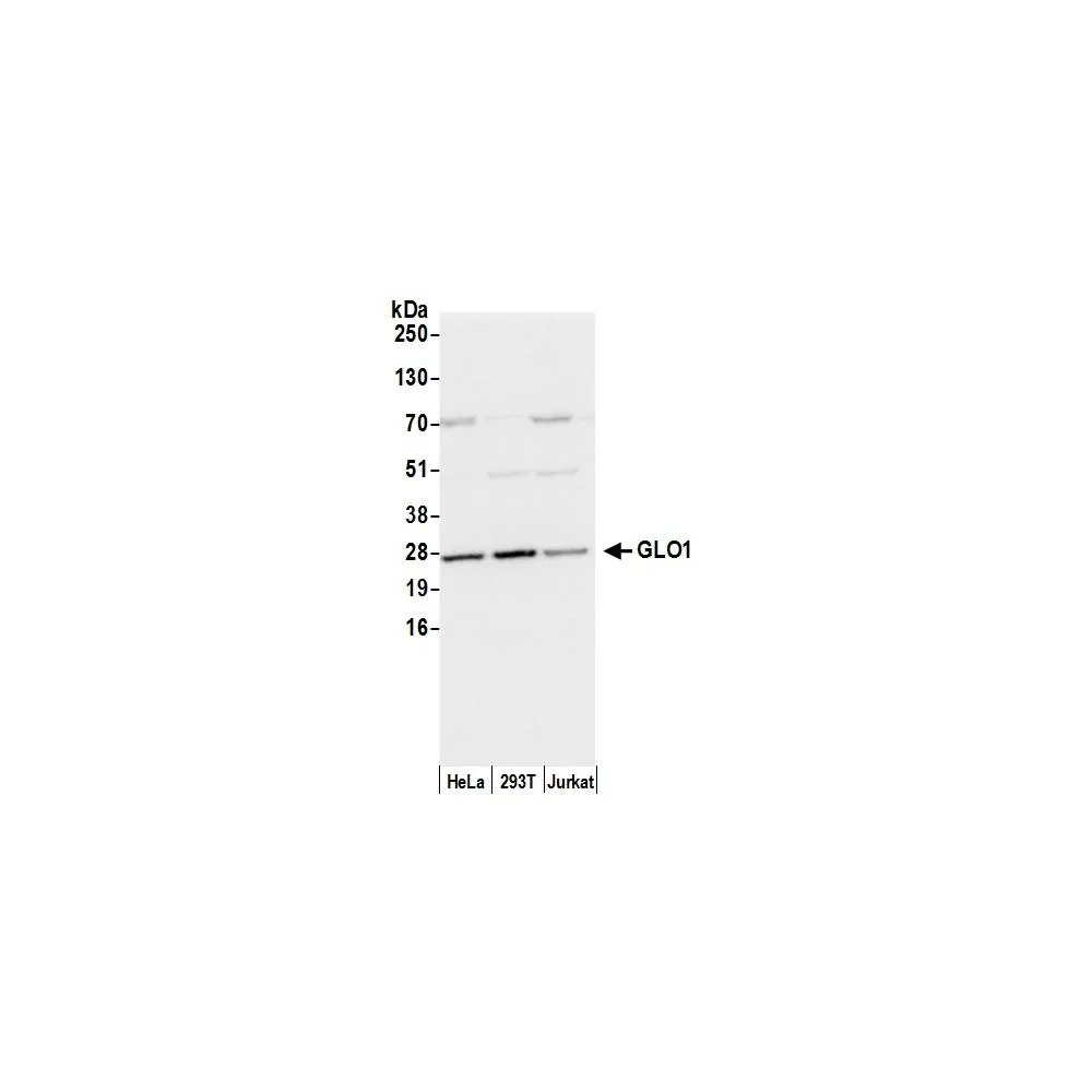 Rabbit anti-GLO1/Glyoxalase I Antibody, Affinity Purified