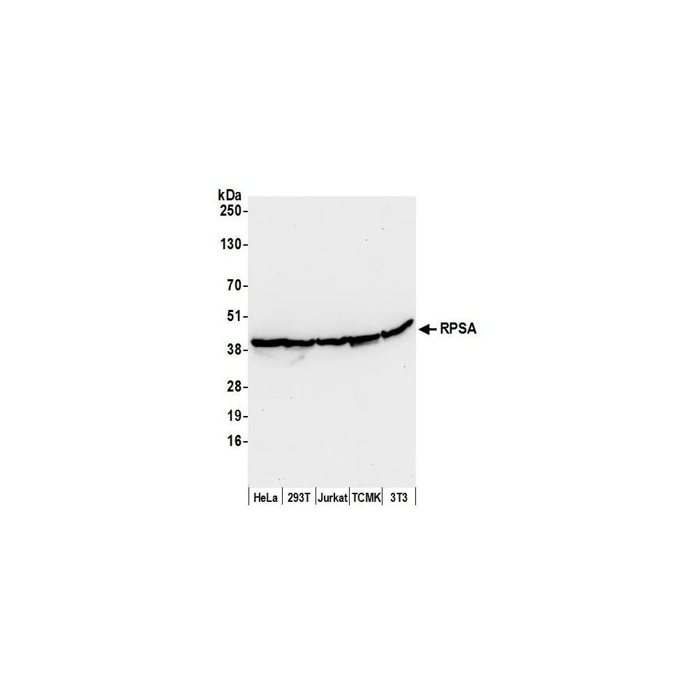 Rabbit anti-RPSA Antibody, Affinity Purified
