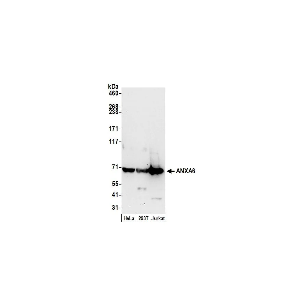 Rabbit anti-ANXA6 Antibody, Affinity Purified