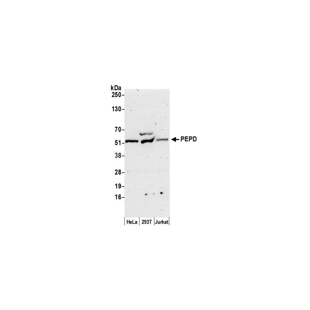 Rabbit anti-PEPD Antibody, Affinity Purified