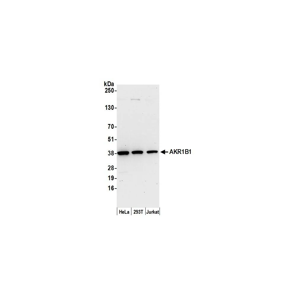 Rabbit anti-AKR1B1 Antibody, Affinity Purified