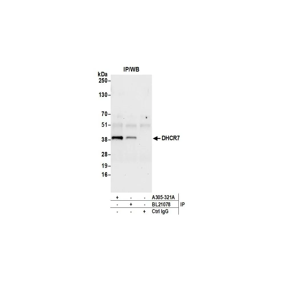 Rabbit anti-DHCR7 Antibody, Affinity Purified