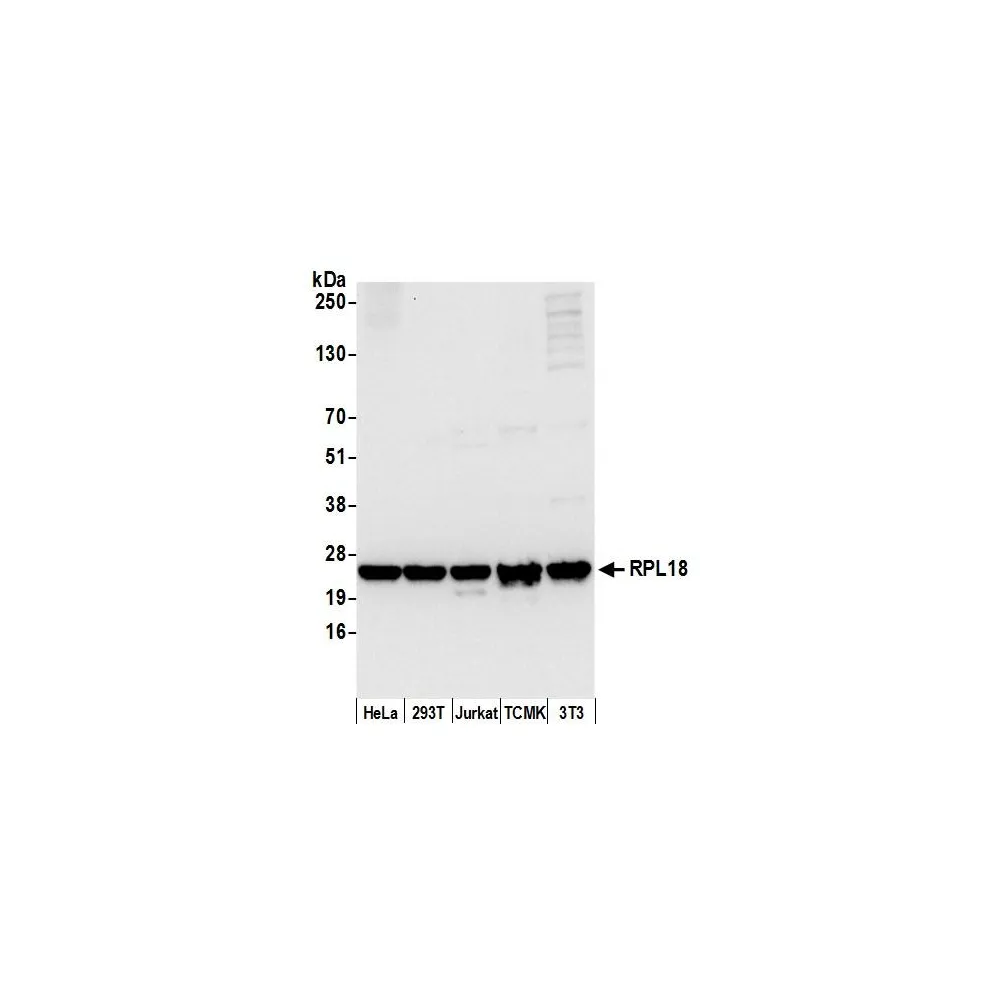 Rabbit anti-RPL18/Ribosomal Protein L18 Antibody, Affinity Purified