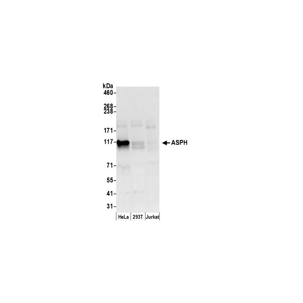 Rabbit anti-ASPH Antibody, Affinity Purified