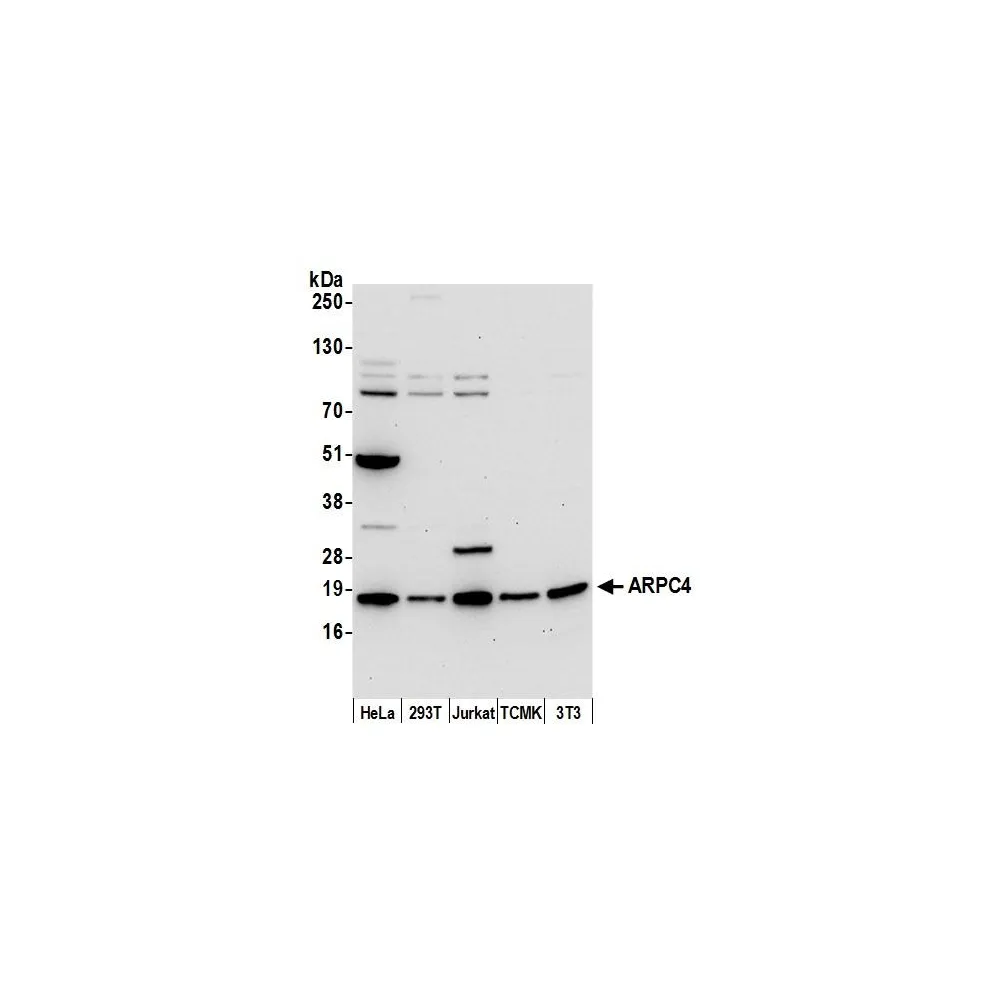 Rabbit anti-ARPC4 Antibody, Affinity Purified