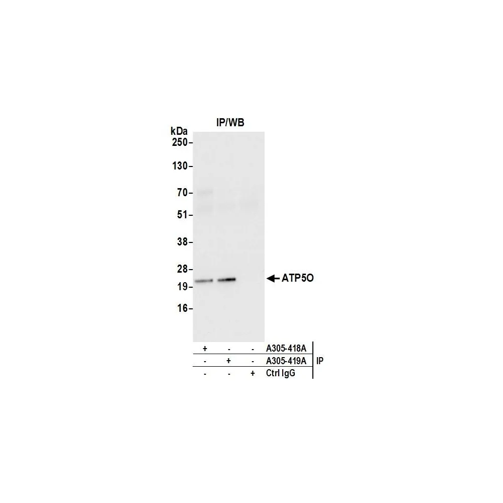 Rabbit anti-ATP5O Antibody, Affinity Purified