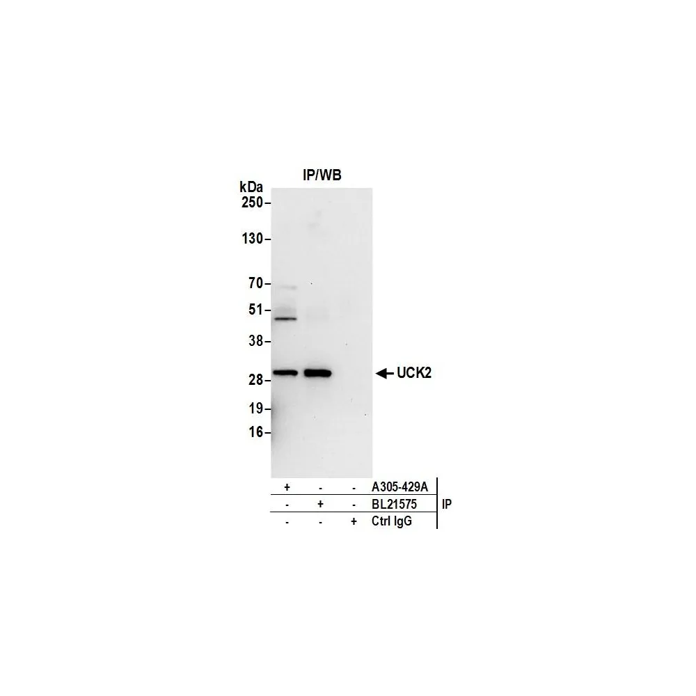 Rabbit anti-UCK2 Antibody, Affinity Purified