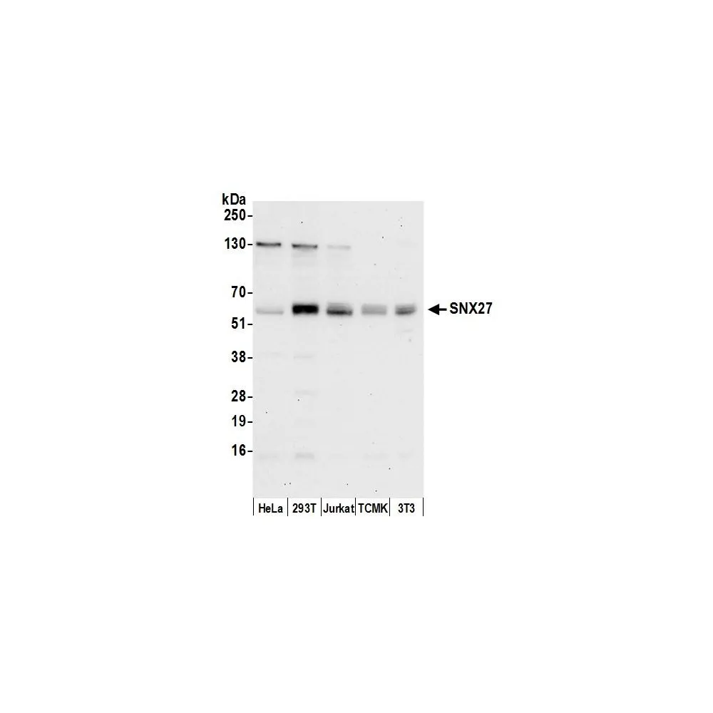 Rabbit anti-SNX27 Antibody, Affinity Purified