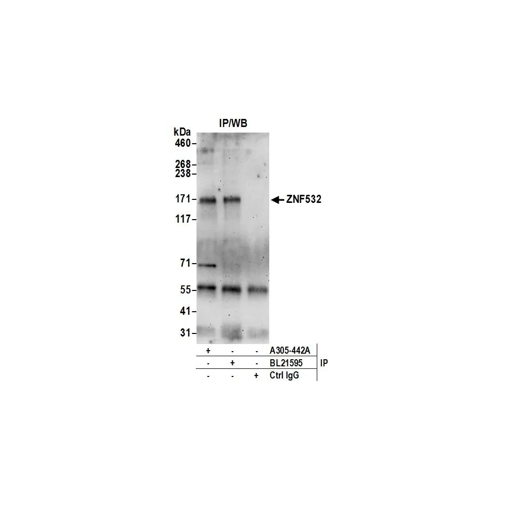 Rabbit anti-ZNF532 Antibody, Affinity Purified