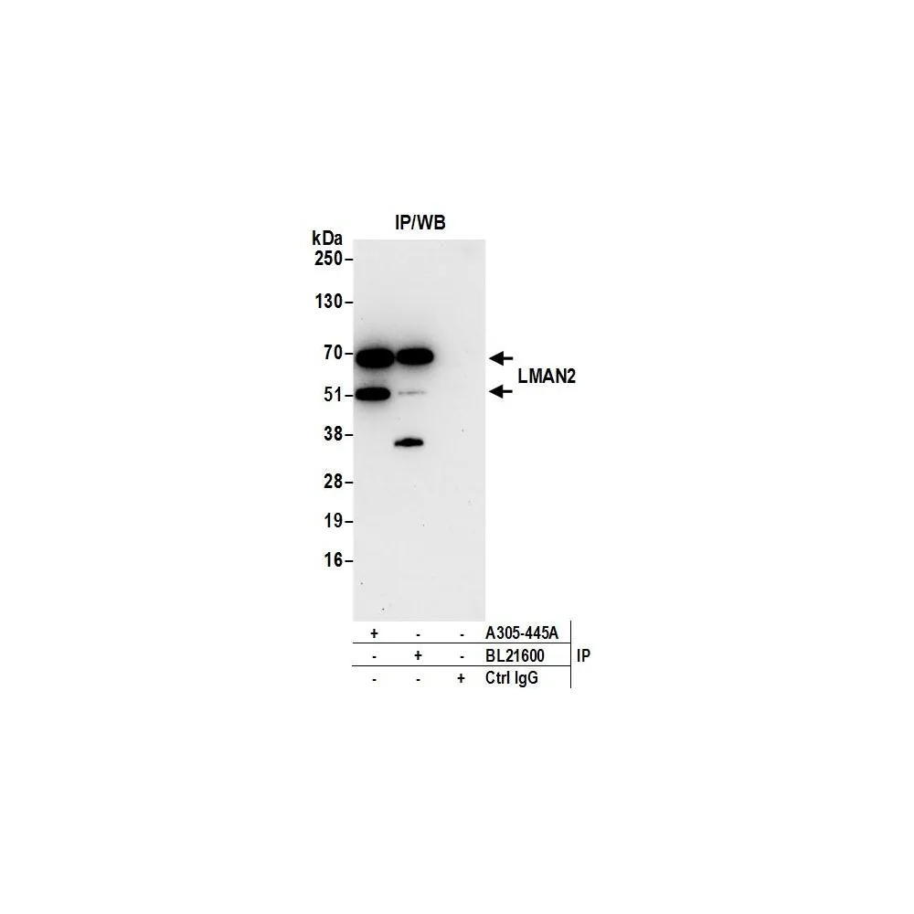 Rabbit anti-LMAN2 Antibody, Affinity Purified
