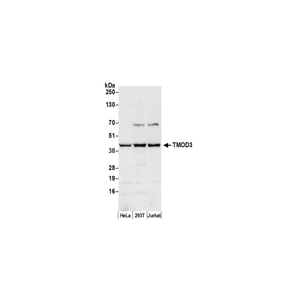 Rabbit anti-TMOD3 Antibody, Affinity Purified