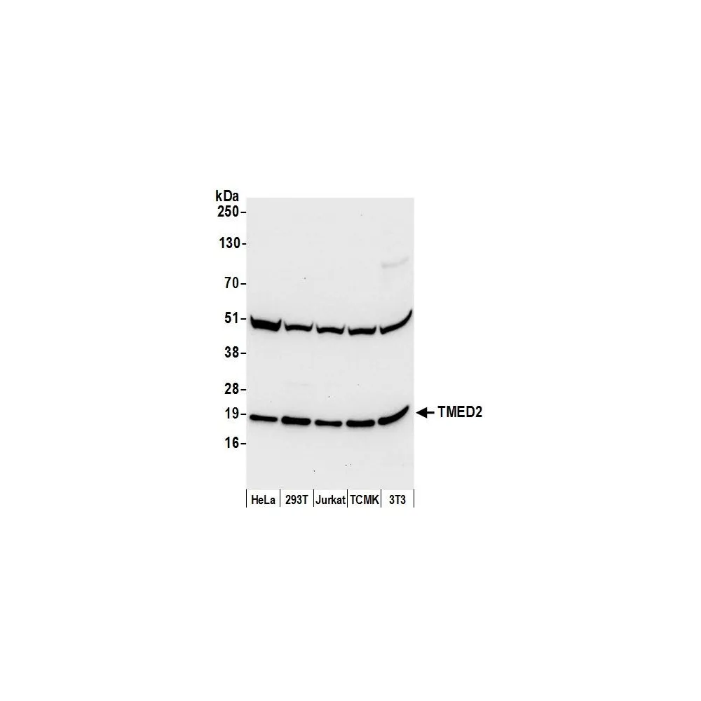 Rabbit anti-TMED2 Antibody, Affinity Purified
