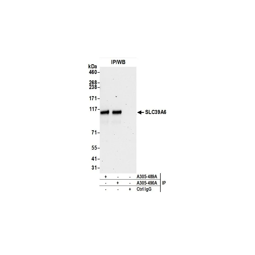 Rabbit anti-SLC39A6 Antibody, Affinity Purified