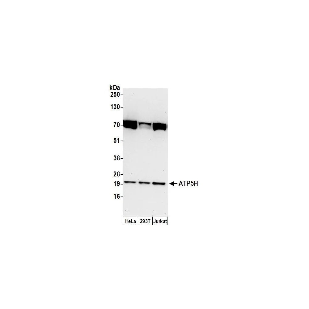 Rabbit anti-ATP5H Antibody, Affinity Purified