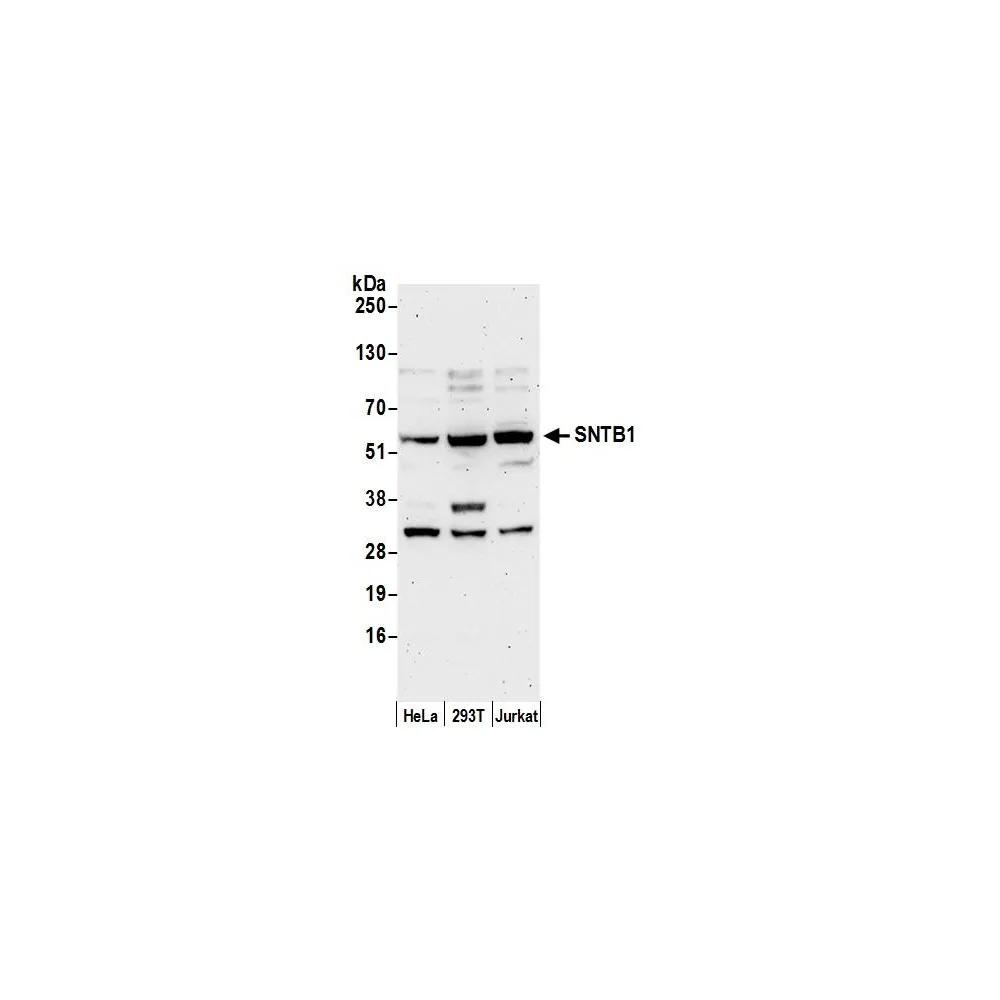 Rabbit anti-SNTB1 Antibody, Affinity Purified