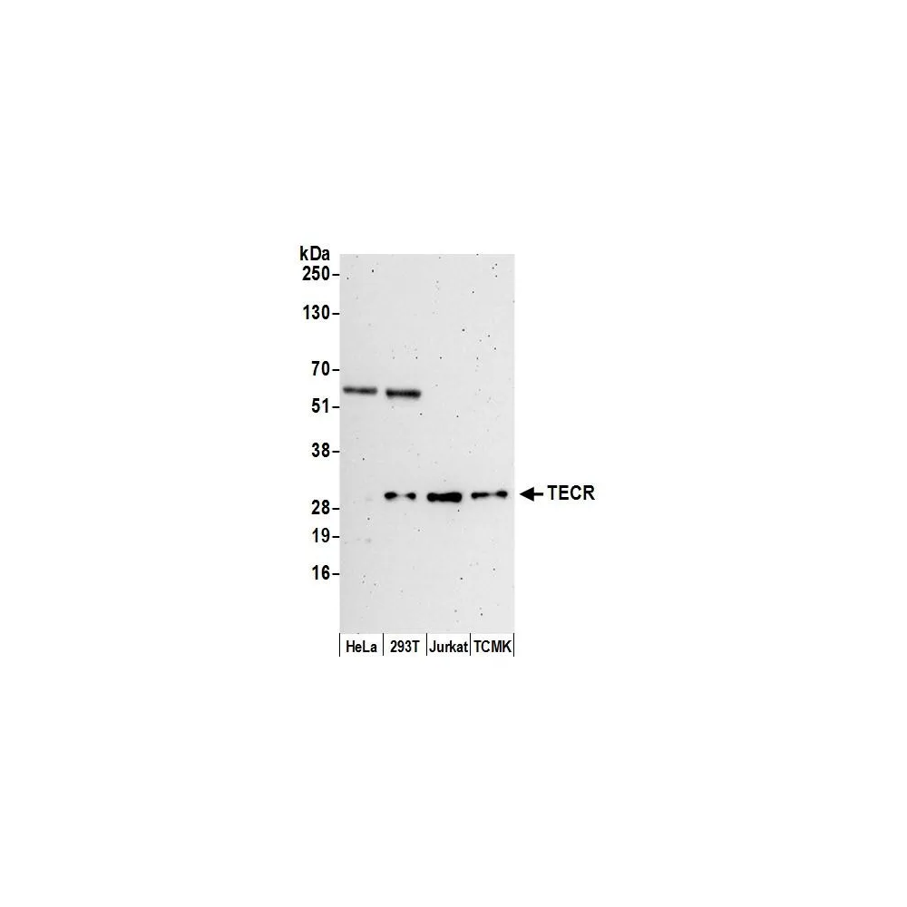 Rabbit anti-TECR Antibody, Affinity Purified