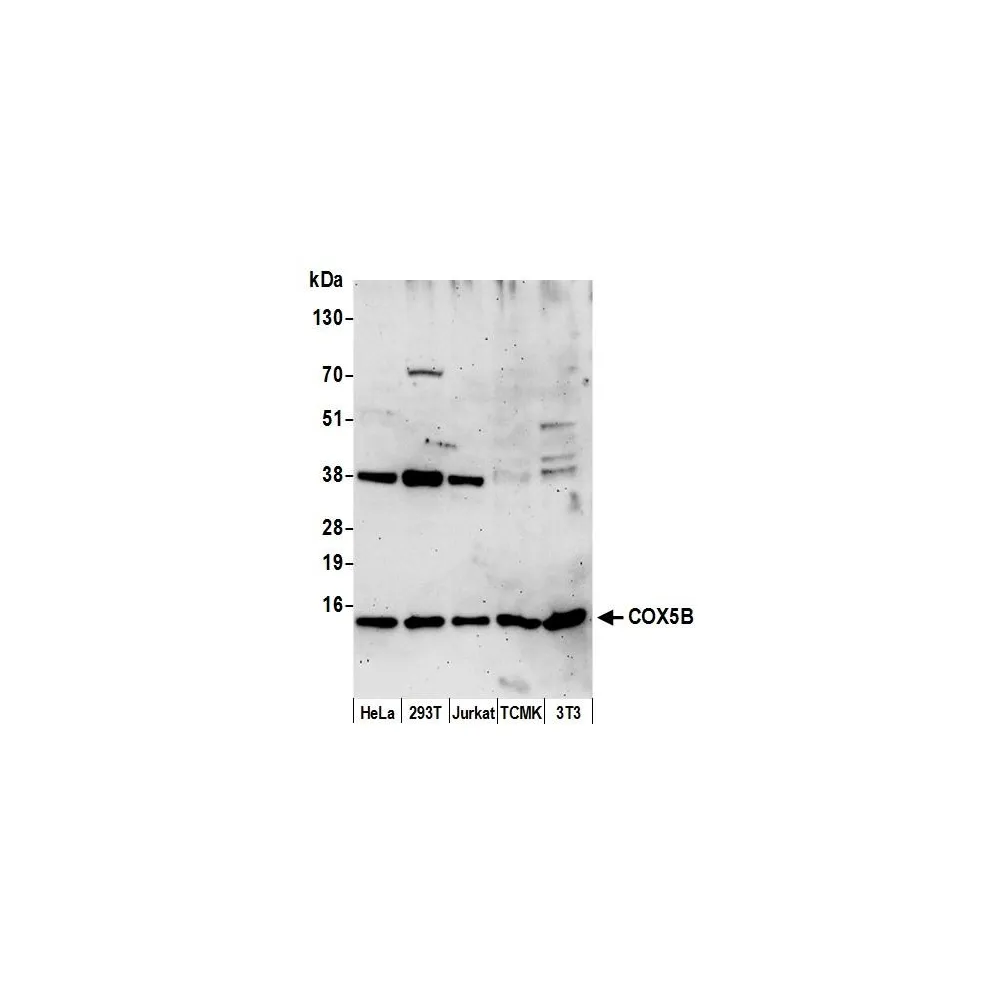 Rabbit anti-COX5B Antibody, Affinity Purified