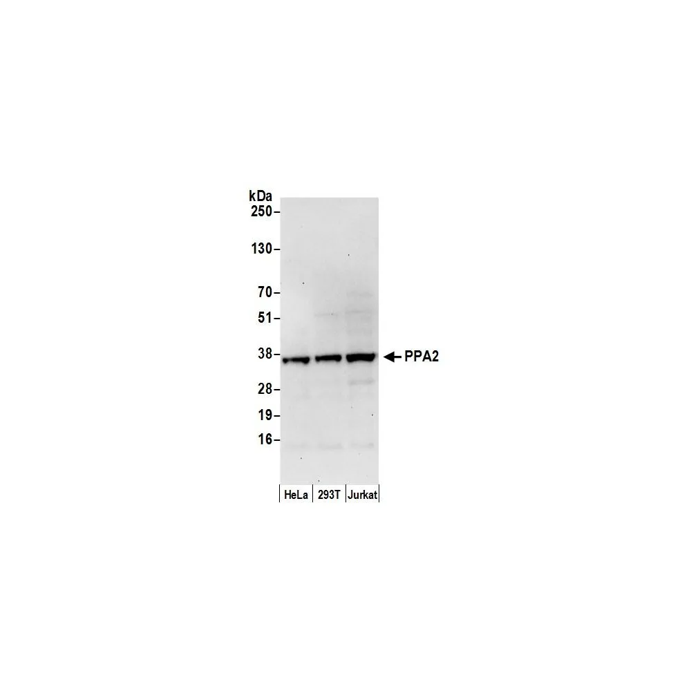 Rabbit anti-PPA2 Antibody, Affinity Purified