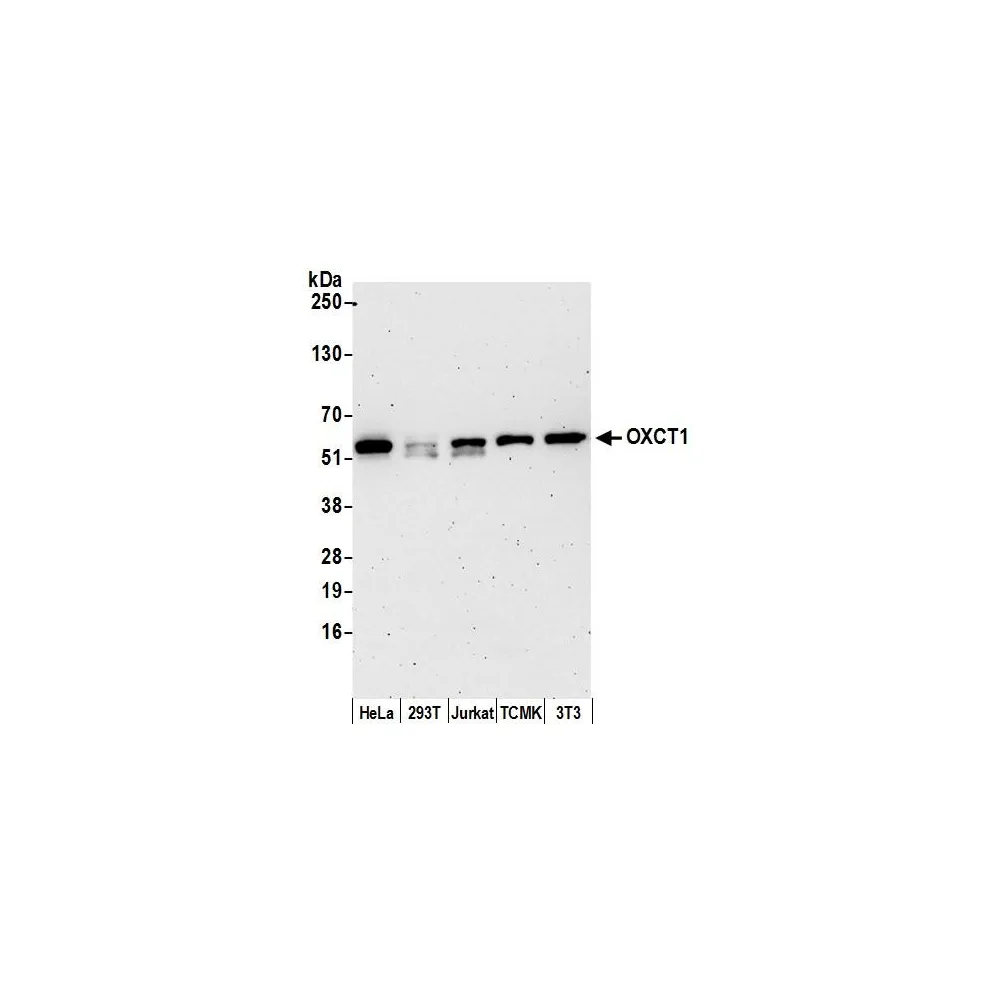 Rabbit anti-OXCT1 Antibody, Affinity Purified