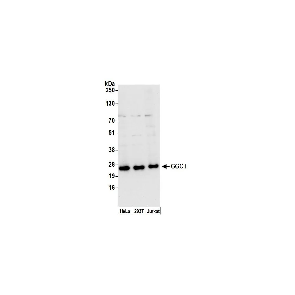 Rabbit anti-GGCT Antibody, Affinity Purified