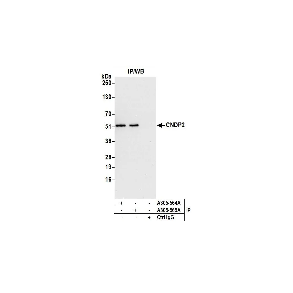 Rabbit anti-CNDP2 Antibody, Affinity Purified