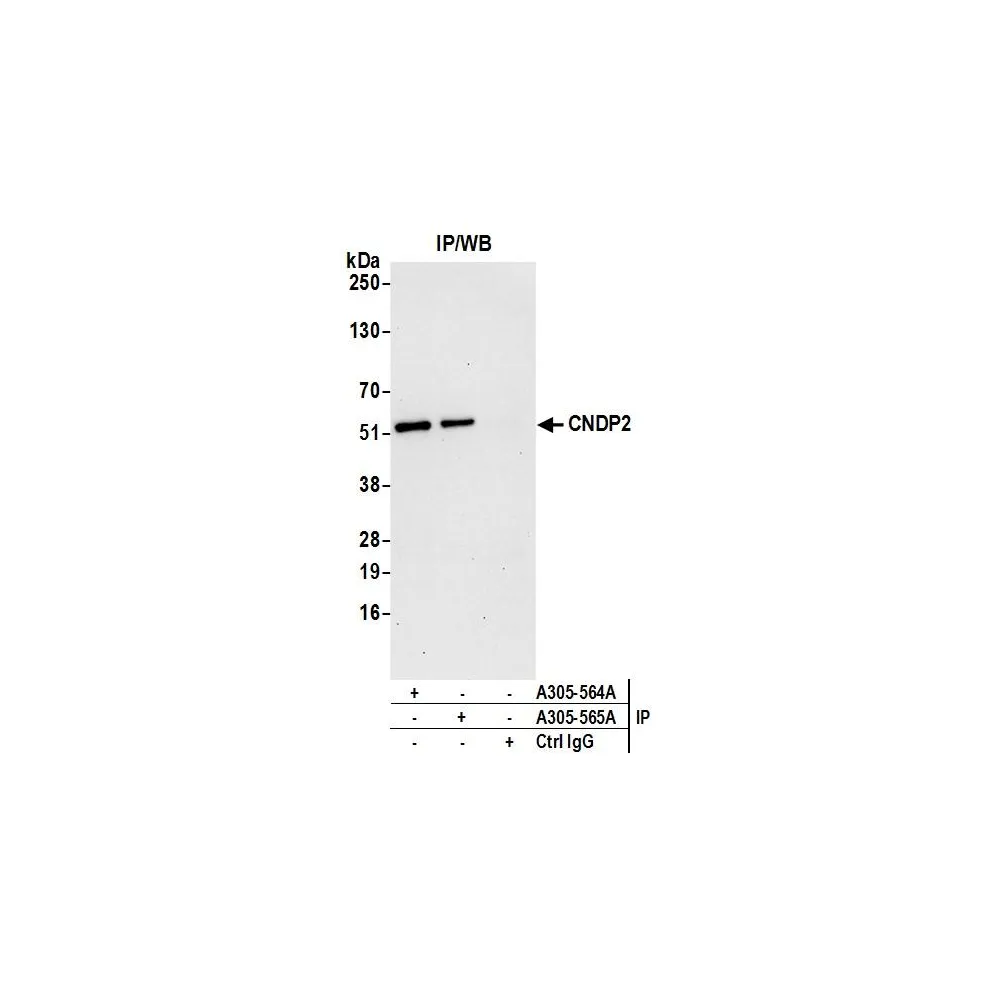 Rabbit anti-CNDP2 Antibody, Affinity Purified