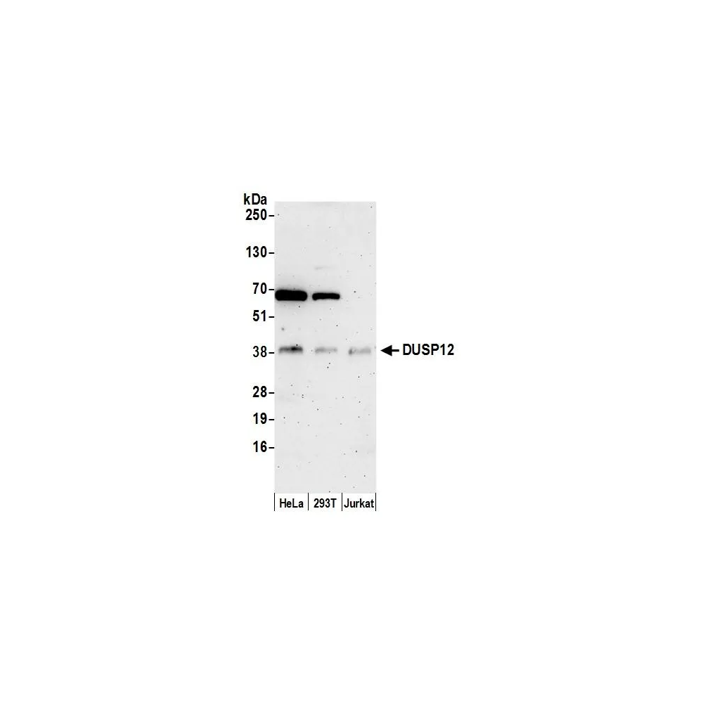 Rabbit anti-DUSP12 Antibody, Affinity Purified