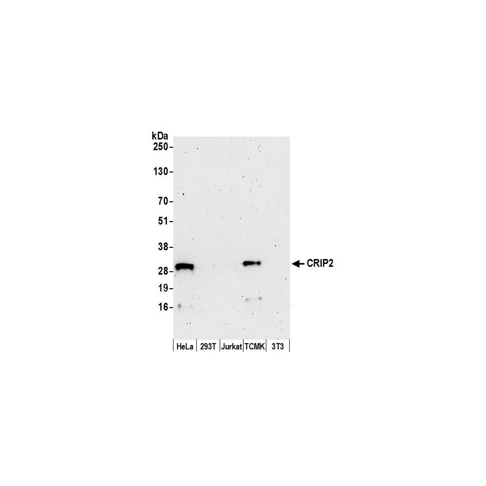 Rabbit anti-CRIP2 Antibody, Affinity Purified